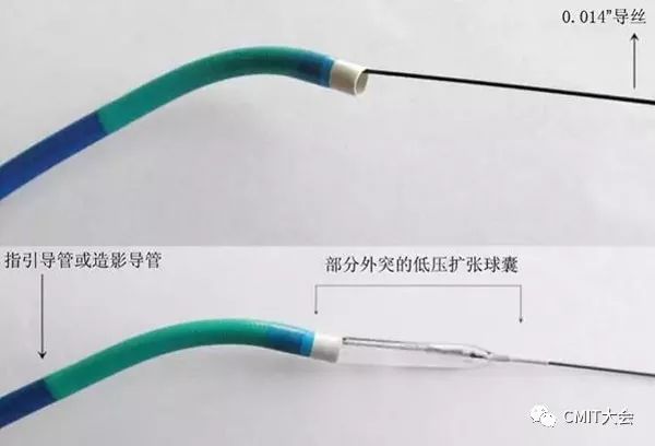 冠脉造影技术成熟不,跟我学技术分析从入门到精通