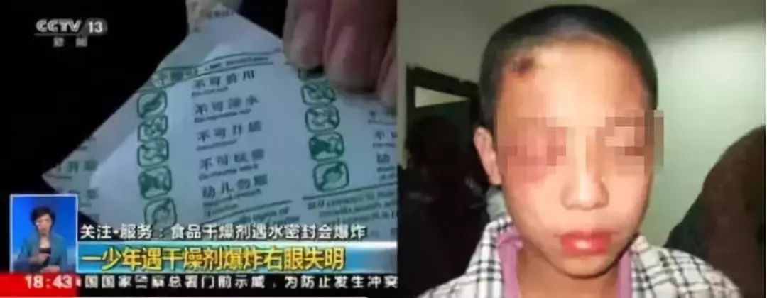 7岁男孩眼球被炸后融化,男童眼球瞬间被融化