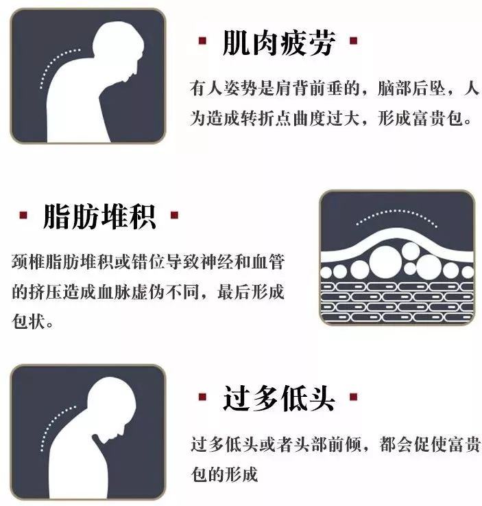 无痛拯救12亿低头族！5分钟搞好酸、痛、僵、麻，解颈椎“夺命包”