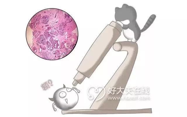 注意丨甲状腺疾病更“偏爱”女性