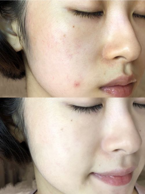 30岁女人必须让自己做到的事,女人30岁了还需要向现实妥协吗