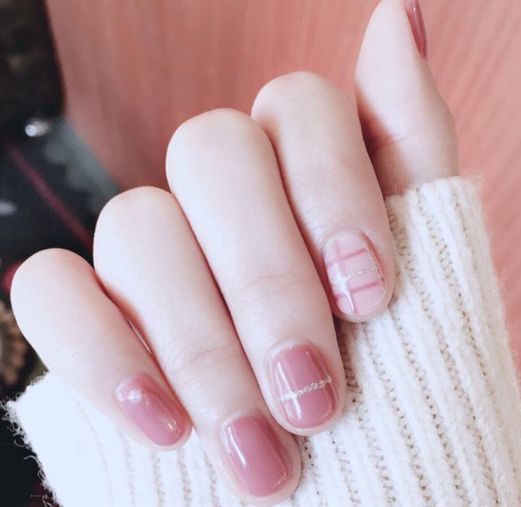 好严重的甲沟炎,离谱的甲沟炎