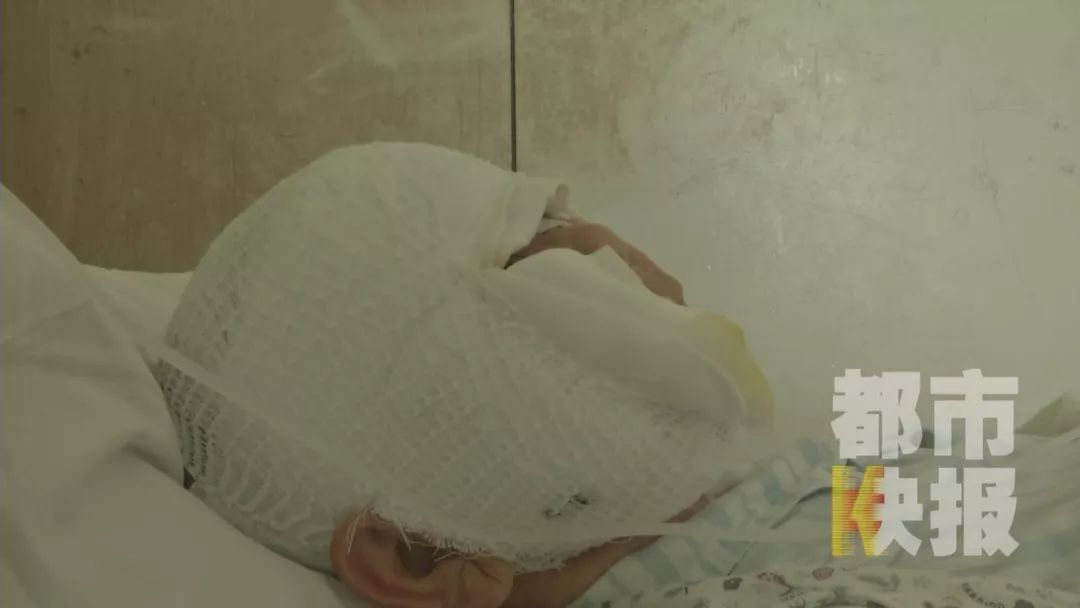 老太被狗死咬后续,一夜之间被野狗咬死