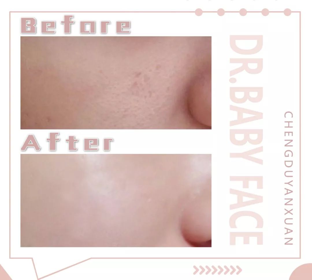 想要素颜想要美颜,想要素颜气色好