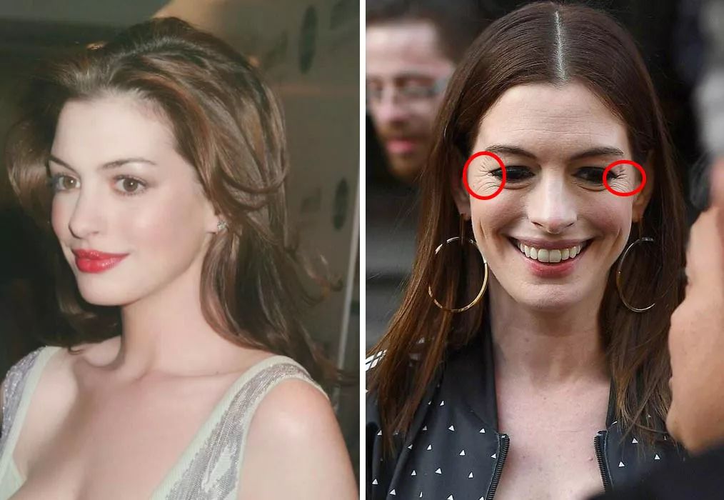 眼膜贴八小时紧致抗皱淡细纹,官方眼膜紧致抗皱淡细纹法令纹