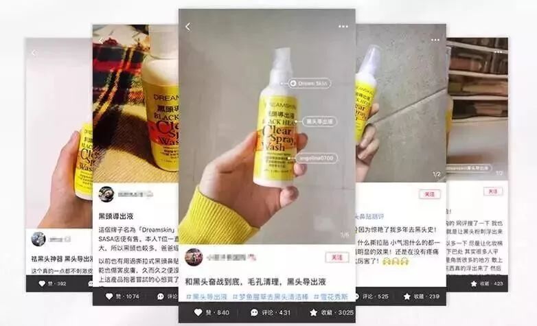 拒绝草莓鼻夹子夹出粉刺,拒绝草莓鼻毛孔粗大