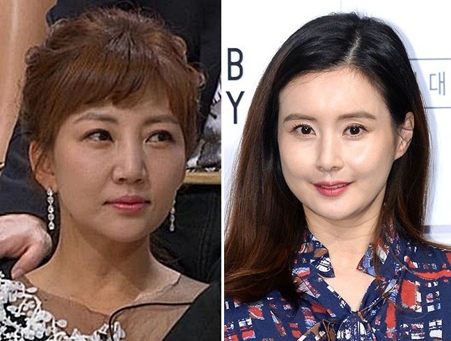 成为法律界人士妻子的韩国明星们