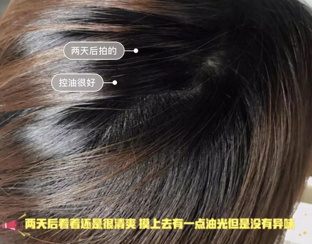 一根头发值25块,一根头发价值多少钱