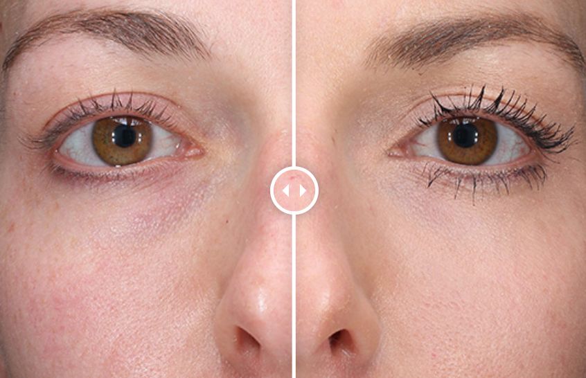 一款超值眼霜,一支2000元的眼霜能治眼袋