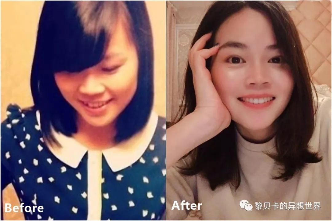 最短只要一年，这件事做对了堪比整容