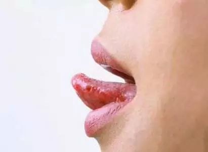 打嗝不止怎么办中医教你小偏方,打嗝不止怎么办最快最有效的方法