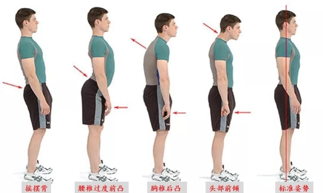 颈椎生理曲度异常怎么回事,颈椎生理曲度反曲的意思