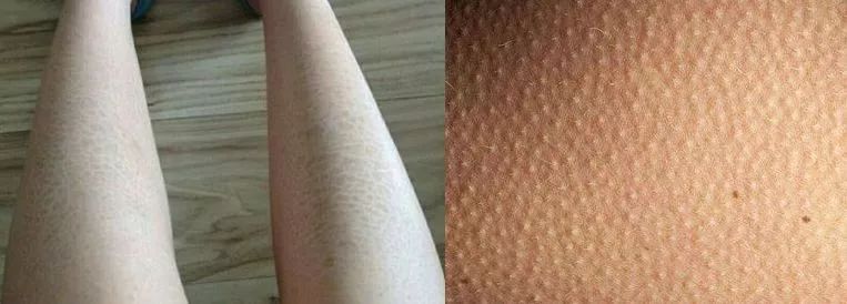 玻尿酸制作中如何干燥,玻尿酸3小时保湿力