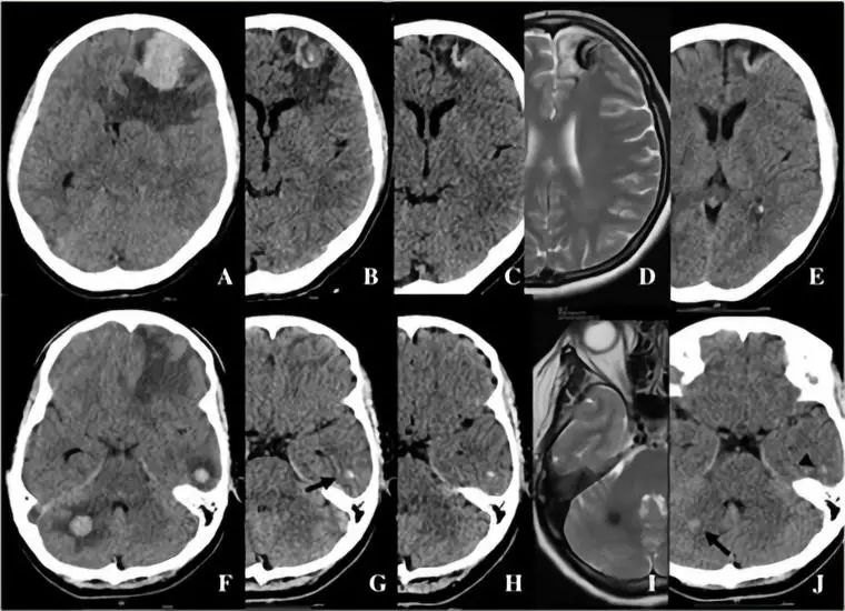 神经影像,神经影像解剖图