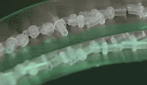 水笔写不出来了怎么办小技巧,水笔写着写着不出水了怎么回事