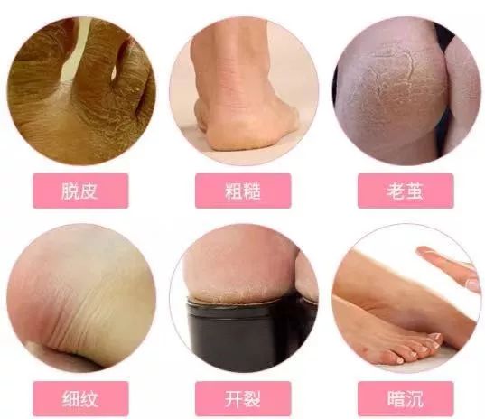 呵护手足|戴手套=精油SPA？还不耽误玩手机？30分钟急救手膜足膜，死皮老茧全消失，让你从头嫩到脚