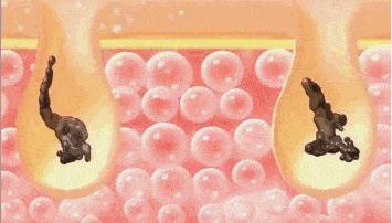 超强搓泥搓澡巾日本制,日式搓澡巾强力搓泥神器