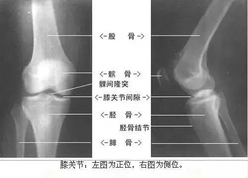 足正常x线解剖图解,常规x线影像解剖图怎么看