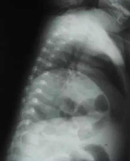 临床思考：新生儿呼吸窘迫的原因是什么？