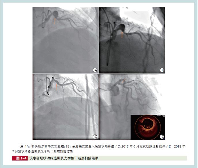 阜外医院乔树宾医生怎么样,阜外医院乔树宾简历