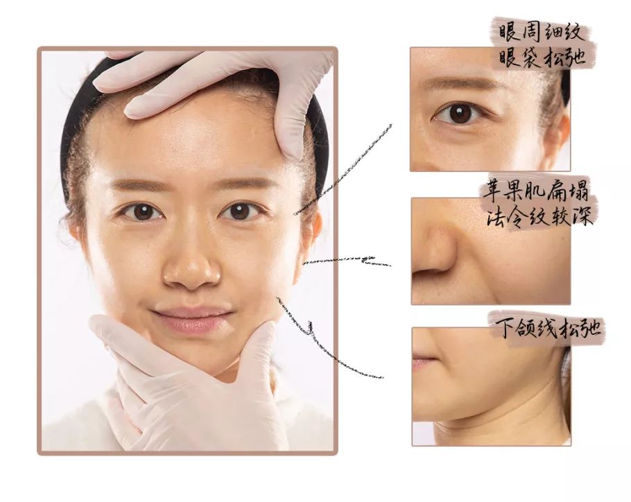 地表最强修复肌肤屏障,地表最强肌诊室