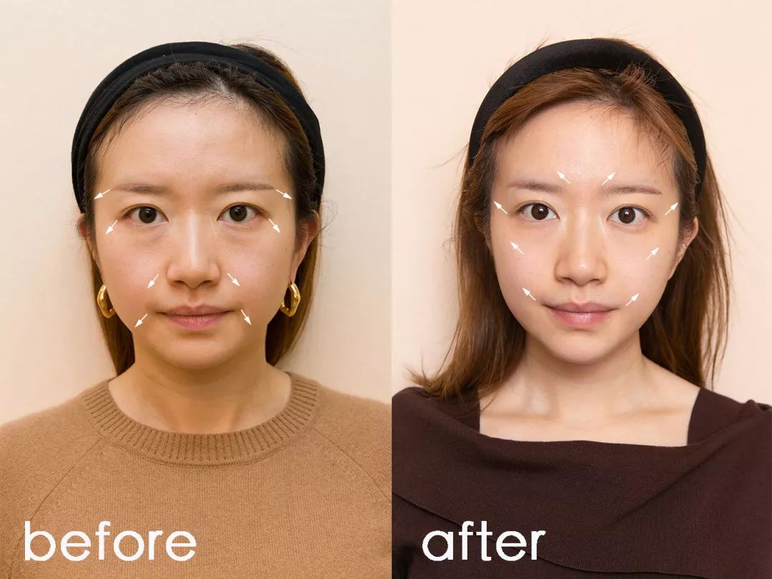 地表最强修复肌肤屏障,地表最强肌诊室