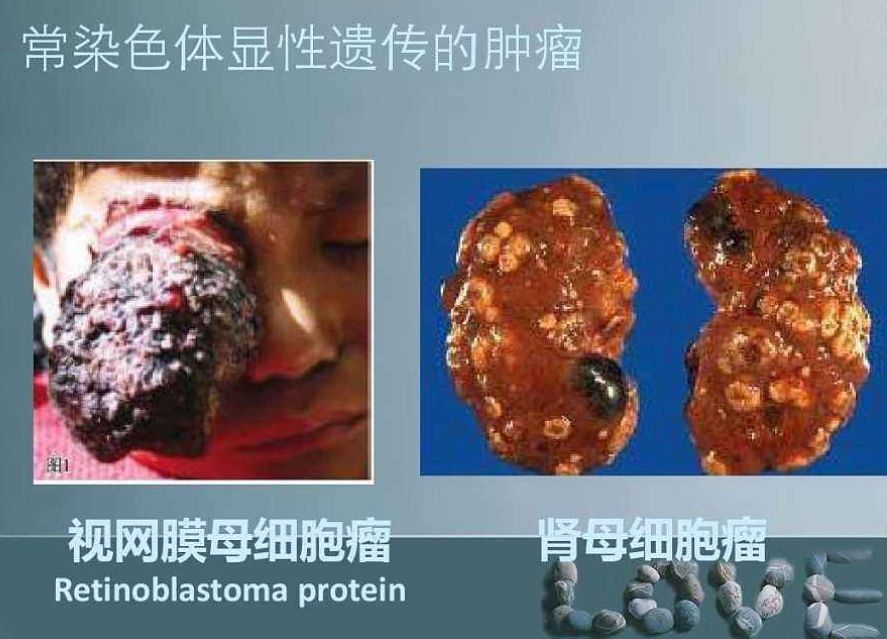 最好的罕见肿瘤药,肿瘤及罕见病目录
