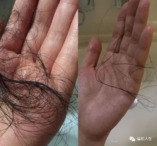 德国老太太用什么洗发水,93岁德国老太太