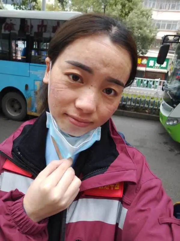 李宗羽：贵州第二批援鄂医疗队队员，六盘水市人民医院榜样