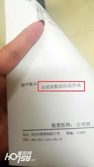 航天级无创体检仪登陆肇庆院子，1分钟告别亚健康