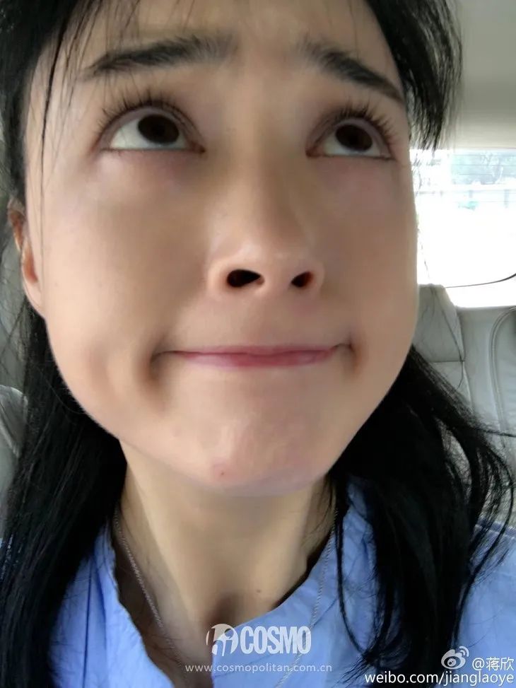 美人计|听说戴口罩之后就疯狂冒痘，我来给你诊断诊断