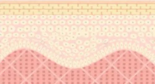 嘴唇干裂起皮等皮掉了涂唇膏,嘴唇干脱皮用什么唇部护理比较好?