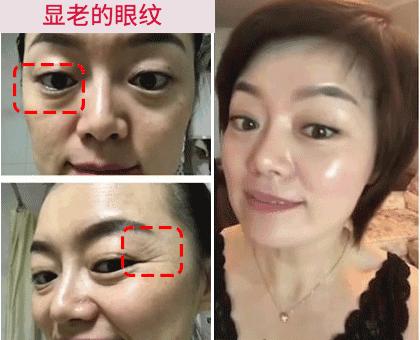 不起眼的乳膏有哪些,药店有一种不起眼的乳膏