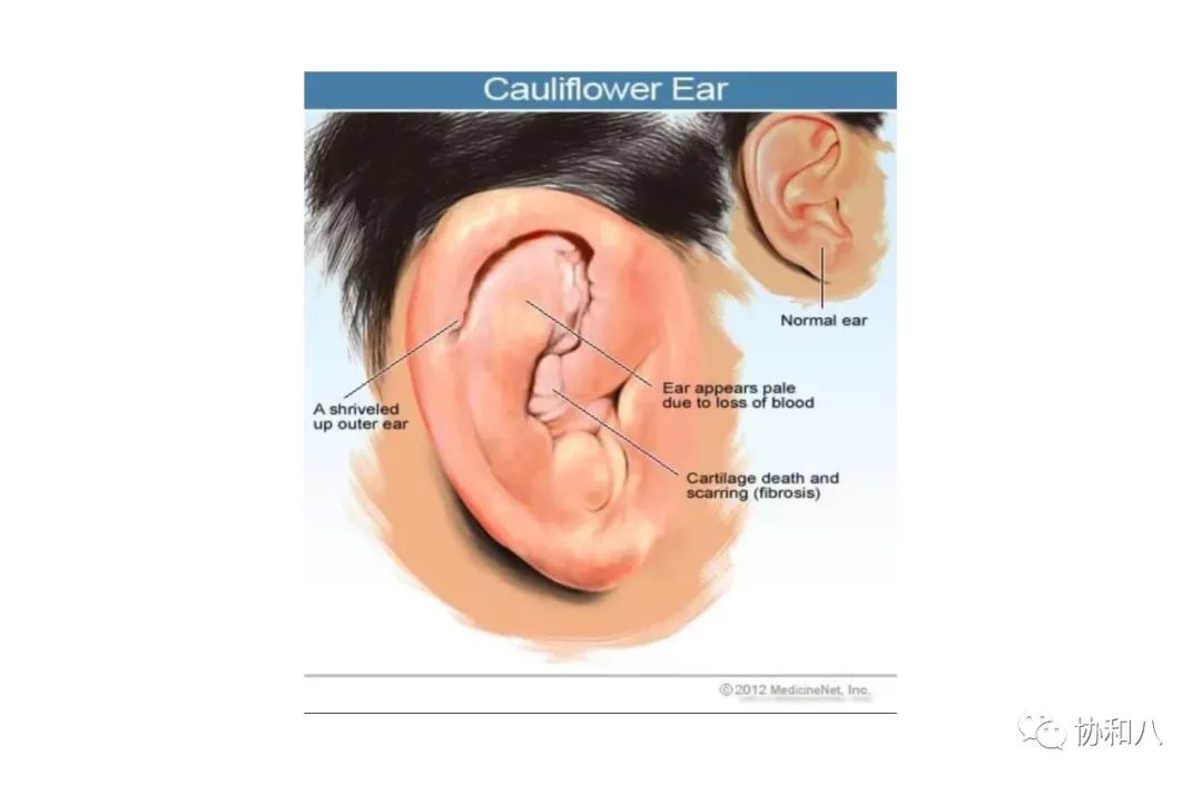 复习这些名解时总觉得怪饿的|协和八·脑洞大开