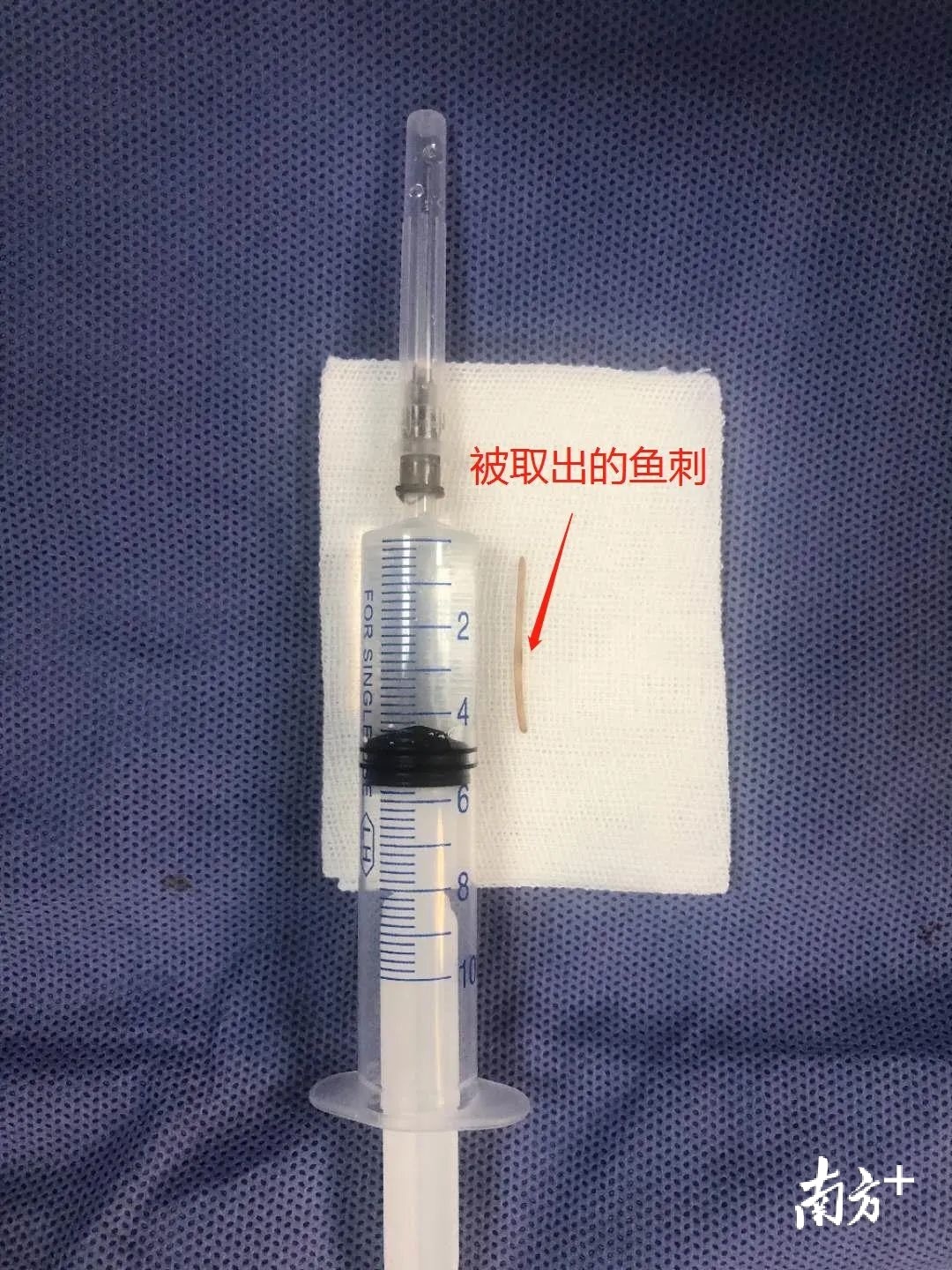 一女子怀疑得痔疮,一名女子得了痔疮结果痔疮破裂