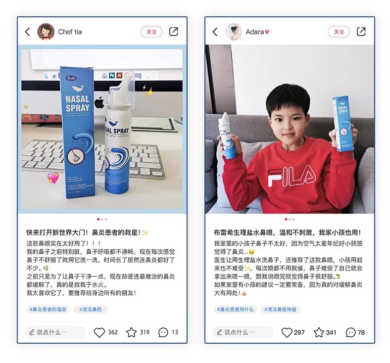 鼻炎太折磨人了怎么治呢,鼻炎折磨人吗