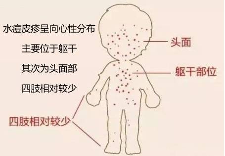 警惕这种病已到高发季,这种病进入高发季一定记住这几点