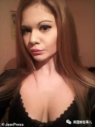 27次手术丰唇,女子疯狂整容100次成芭比疯狂丰唇