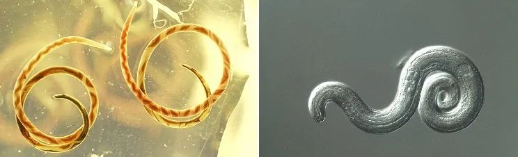 广东男童感染寄生虫病,男童寄生虫病