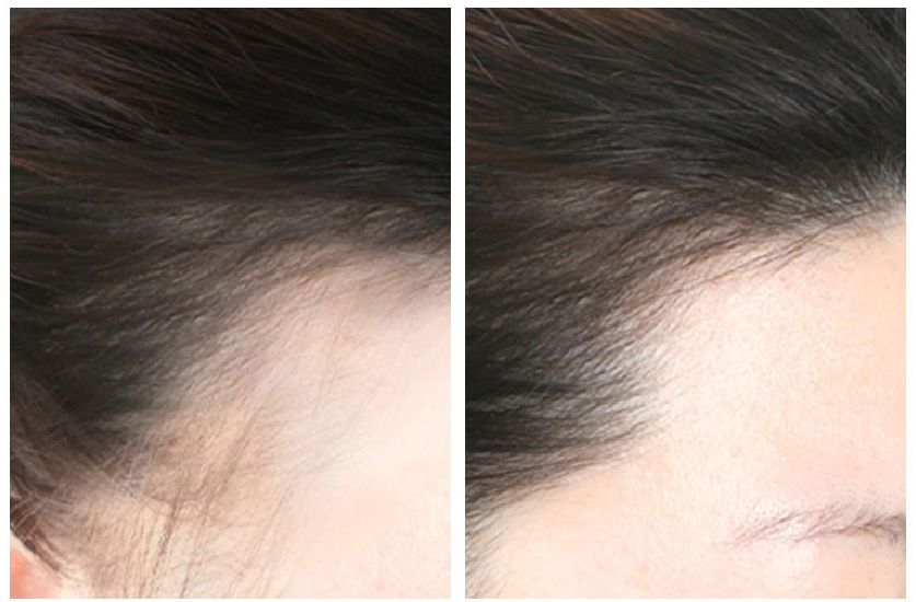 生姜育发洗发水推荐,生姜育发洗发水哪款最有效果