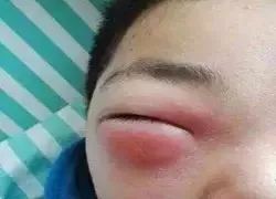 屋里白色小飞虫咬人,家里好多黑色的带壳小飞虫咬人吗