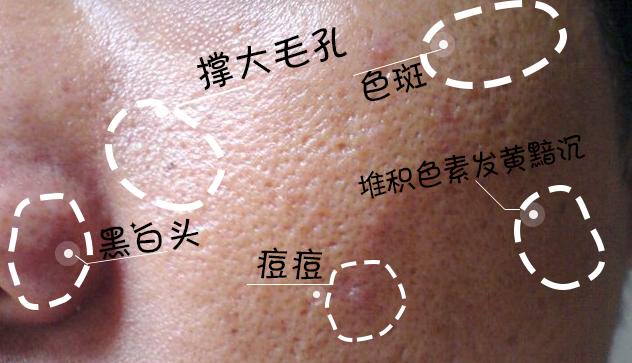 蜜诗肌酵素去角质凝胶,蜜诗肌酵素去角质