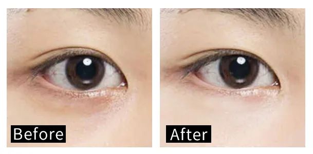 眼霜中的爱马仕!清爽不长脂肪粒,去黑眼圈效果秒2000元腊梅,亲测有效