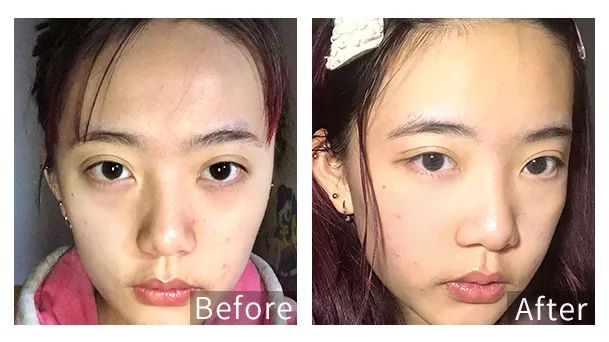 眼霜中的爱马仕!清爽不长脂肪粒,去黑眼圈效果秒2000元腊梅,亲测有效