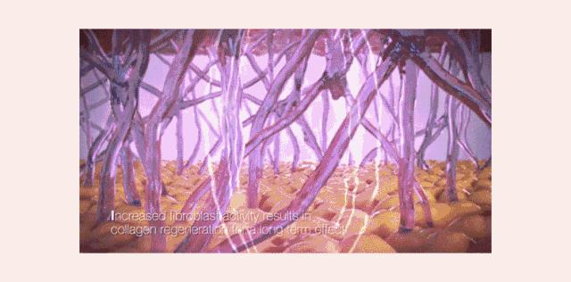 怎么科学有效延缓皱纹,9个原因让你的皱纹长得飞快