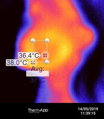 如何笑不长皱纹,70岁以上不长皱纹怎么办