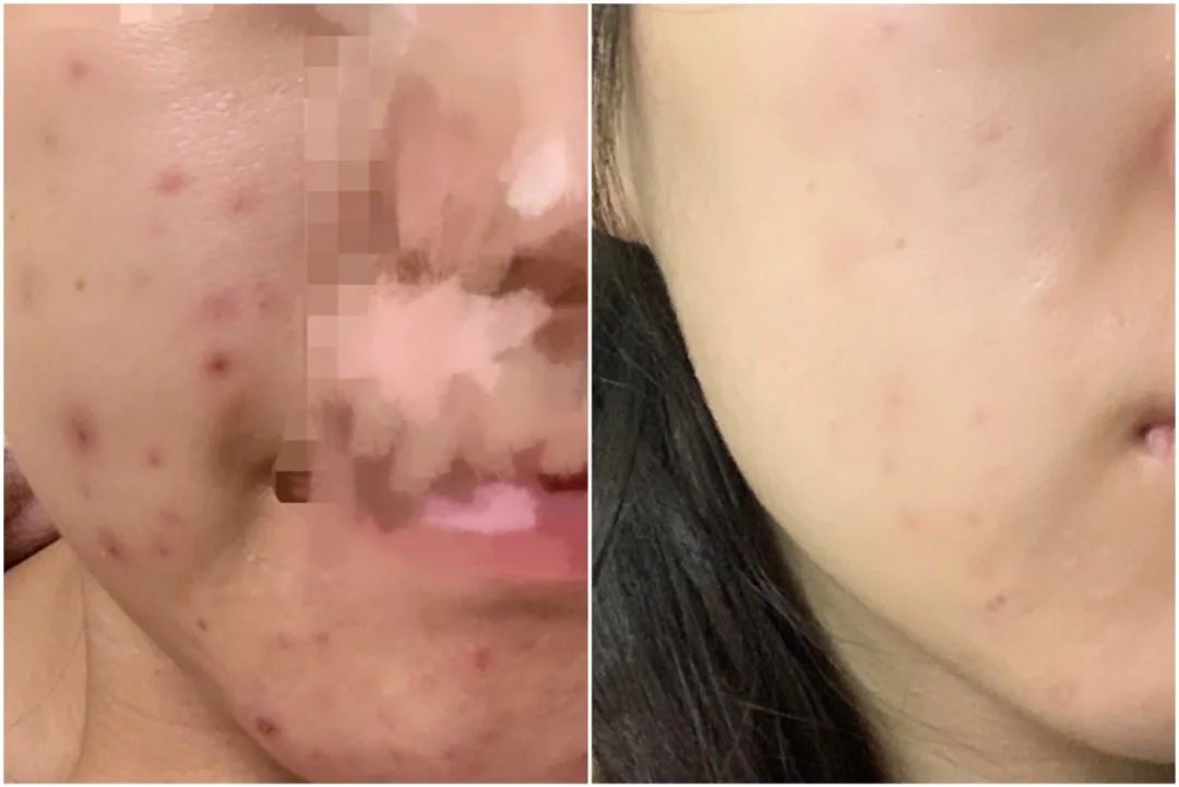 做完医美真的能换脸吗,做完医美需要注意什么