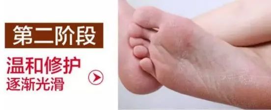 脚臭脱鞋多久可以去味,脱鞋臭脚怎么快速除臭