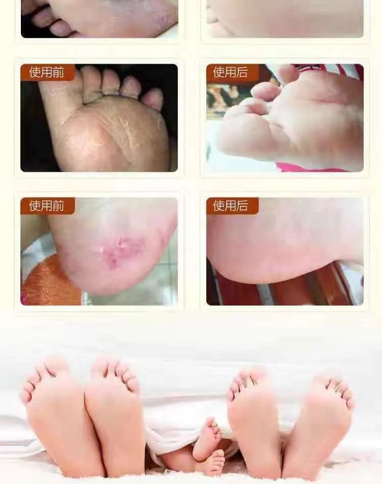 冬天脱鞋脚臭怎么办,长时间没办法脱鞋怎么防止脚臭