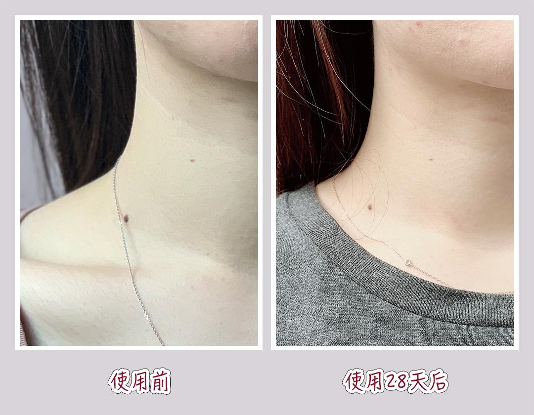 澶у瀷鐩茬洅娴嬭瘎,娴嬭瘎澶у瀷鐩茬洅